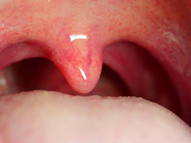 primo stato della bocca e dei denti - ugola foto e immagini stock