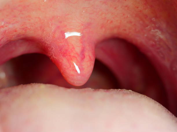 istock Close up of mouth and teeth 1144603036