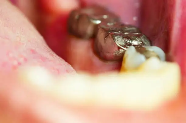 Human Gums, Mouth, Medicine, Romania, Teeth