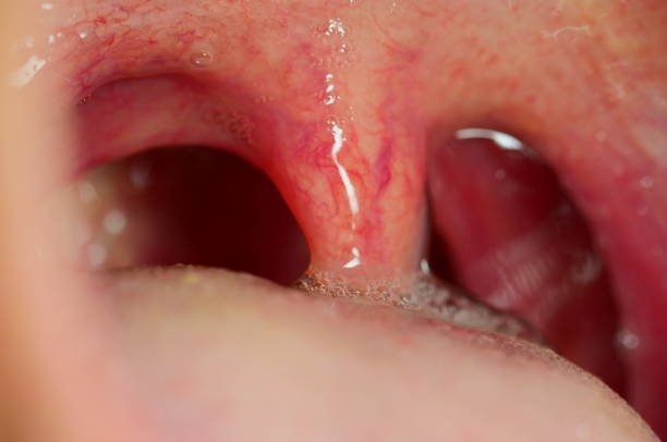 istock Close up of mouth and teeth 1144603064