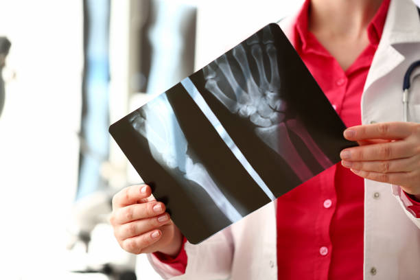 la mujer radióloga tiene una película de radiografía de mano - hueso fotos fotografías e imágenes de stock