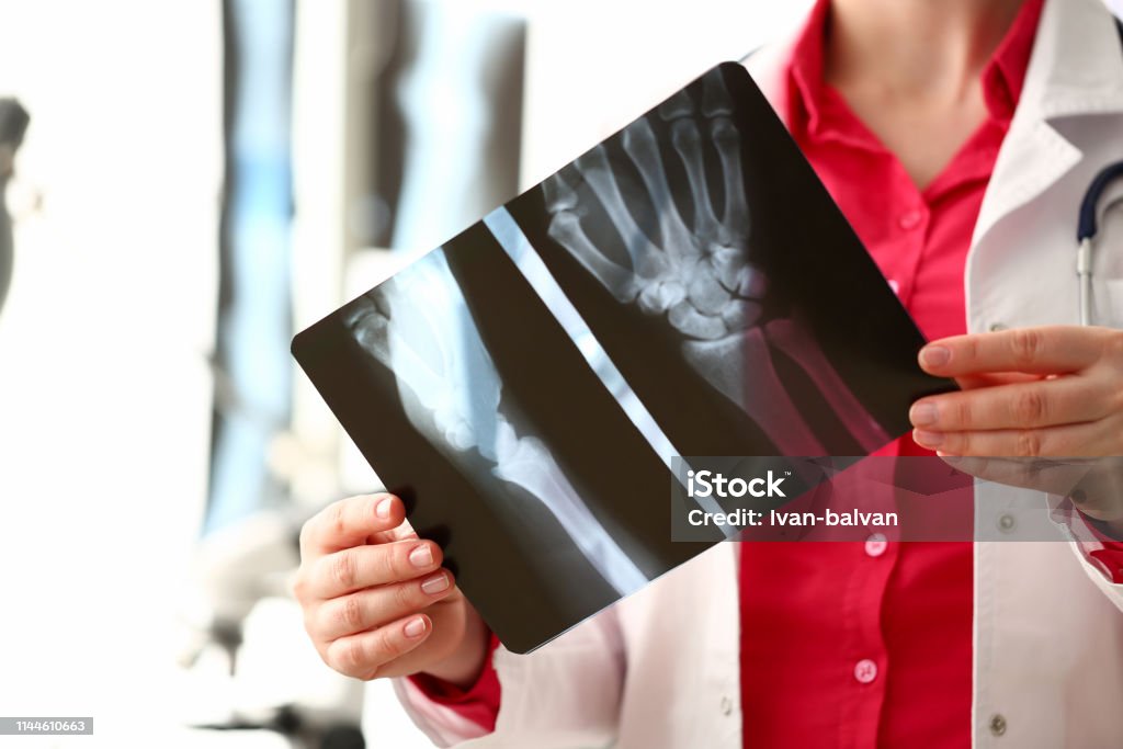 Female radiologist hold in hand xray film Female radiologist hold in hand x-ray film image aganist hospital office background. CT scan of bone health concept. X-ray Image Stock Photo
