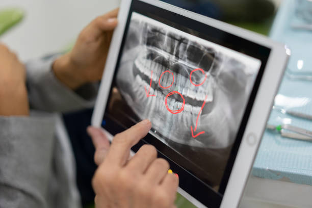 istock Close-up on a boy at the dentist looking at an x-ray 1144800445