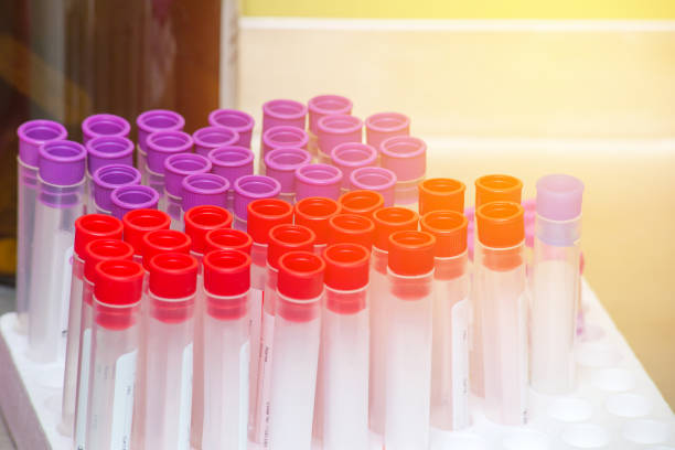 istock tube with collection blood samples in laboratory at hospital 1144801704