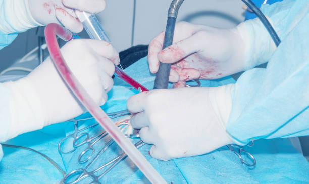 istock Surgery. Removal of spinal hernia 1144832797