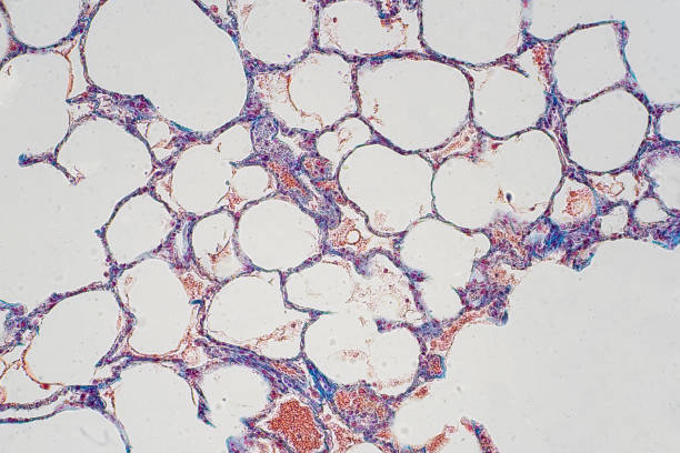 istock Human lung tissue under microscope view. Lungs are the primary organs of the respiratory system in humans and many other animals 1144905212