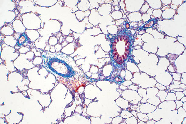 istock Human lung tissue under microscope view. Lungs are the primary organs of the respiratory system in humans and many other animals 1144905213
