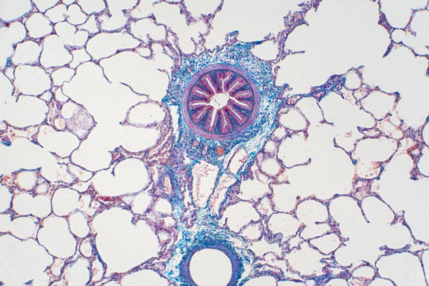 istock Human lung tissue under microscope view. Lungs are the primary organs of the respiratory system in humans and many other animals 1144905227