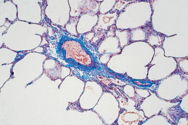 istock Human lung tissue under microscope view. Lungs are the primary organs of the respiratory system in humans and many other animals 1144905235