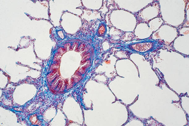 istock Human lung tissue under microscope view. Lungs are the primary organs of the respiratory system in humans and many other animals 1144905244