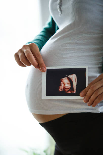 femme enceinte montrant le balayage d’échographie - healthcare and medicine home interior side view vertical photos et images de collection