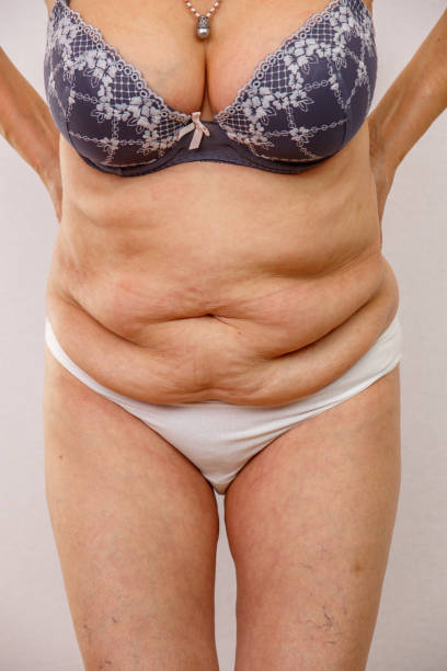 istock elderly woman shows fat belly 1145193941