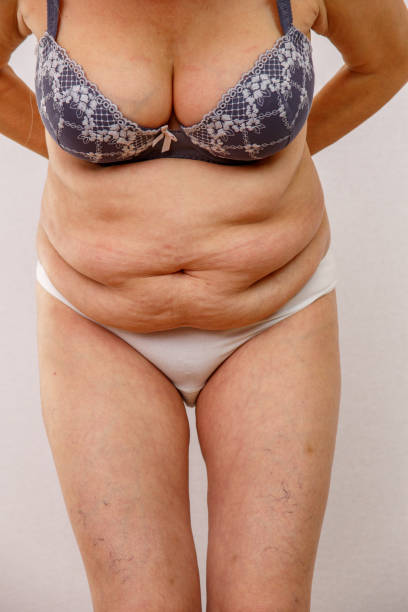 istock elderly woman shows fat belly 1145195628