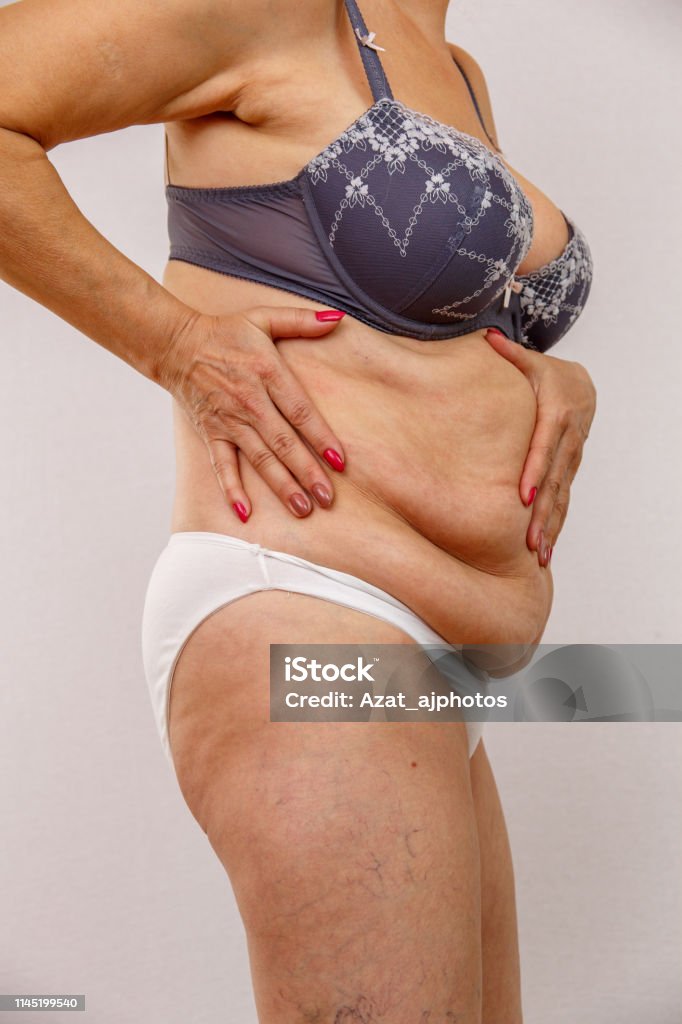 toon studio Westers Elderly Woman Shows Fat Belly Stock Photo - Download Image Now - Abdomen,  Adult, Adults Only - iStock