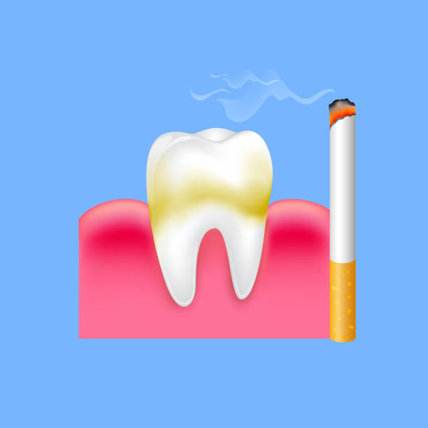 Tooth with cigarette. Smoking effect on human teeth. Dental care concept. Stop smoking, World No Tobacco Day. Illustration on blue background. cartoon of nerds candy stock illustrations