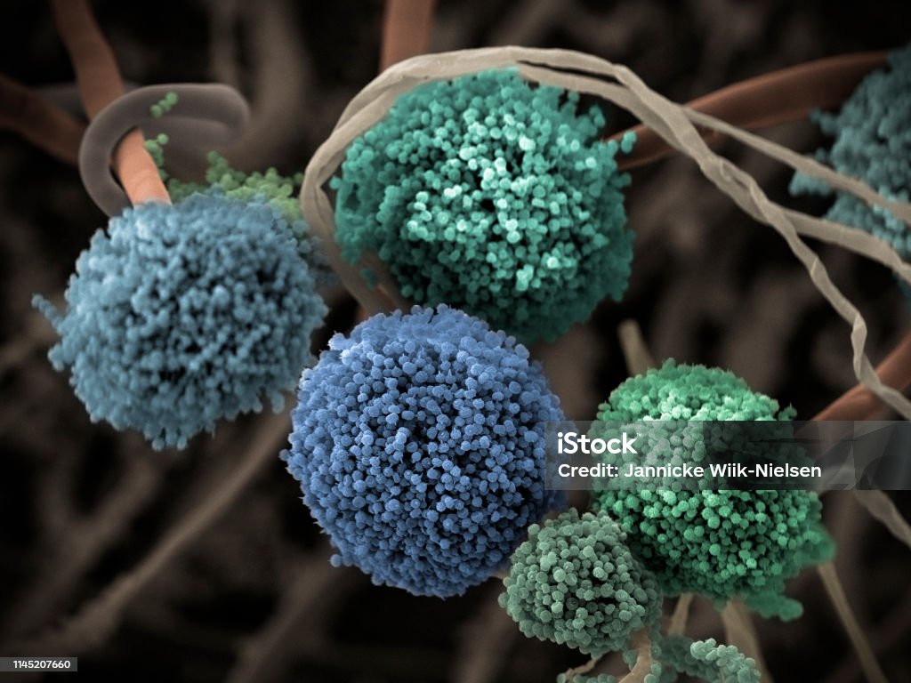 Fungus (Aspergillus niger), SEM Fruiting bodies (conidiophores) and hyphae of the fungus Aspergillus niger. A. niger is a widely distributed saprophyte which grows on household dust, soil, and decaying vegetable matter, including stale food. A. niger is one of the most common causes of fungal ear infections and may result in the serious lung disease aspergillosis in people with compromised immune function or other lung diseases. A. niger is used for waste management and biotransformation in addition to other industrial uses, such as production of citric acid and extracellular enzymes. Coloured scanning electron micrograph (SEM), magnified x415 when printed at 10cm wide. Mycotoxin Stock Photo