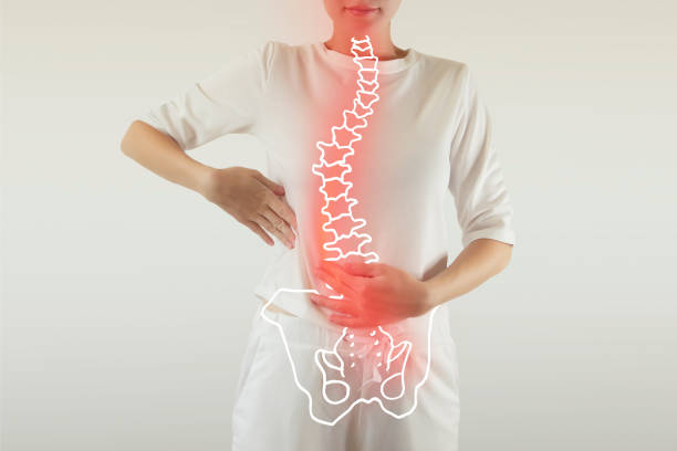 spine with bad posture colored red scoliosis, kiphosis and lordosis / spinal problems cerebrospinal fluid photos stock pictures, royalty-free photos & images