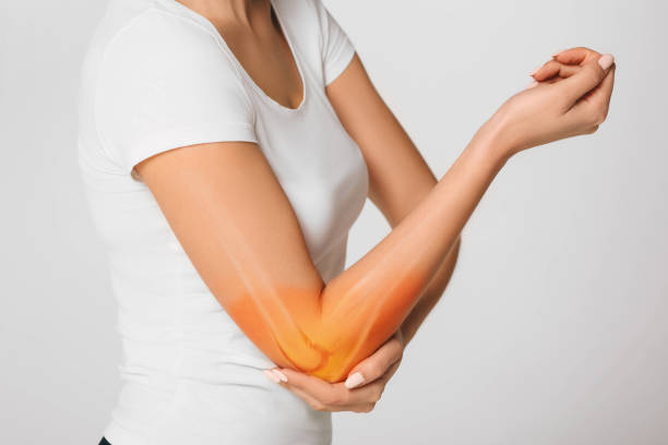 woman suffering pain in the elbow. composite of image arm bones and elbow - elbow imagens e fotografias de stock