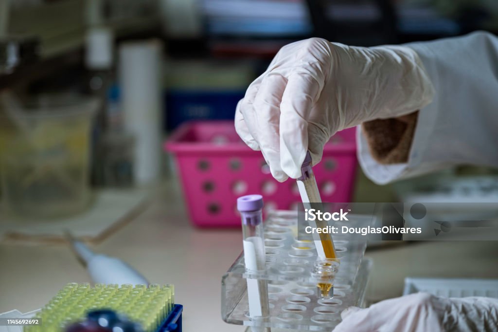 Lab technician with a sample of plasma blood analyzing the results Drug Test Stock Photo