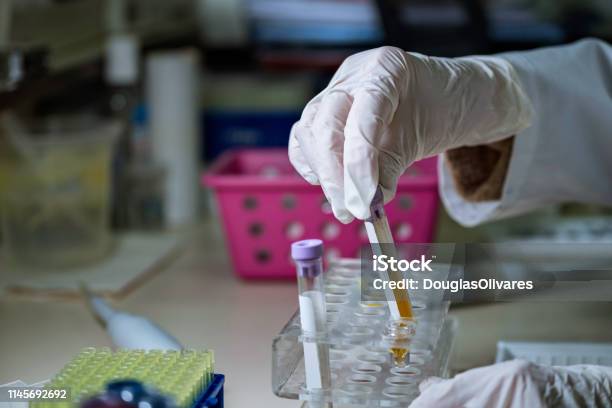 Lab Technician With A Sample Of Plasma Blood Analyzing The Results Stock Photo - Download Image Now