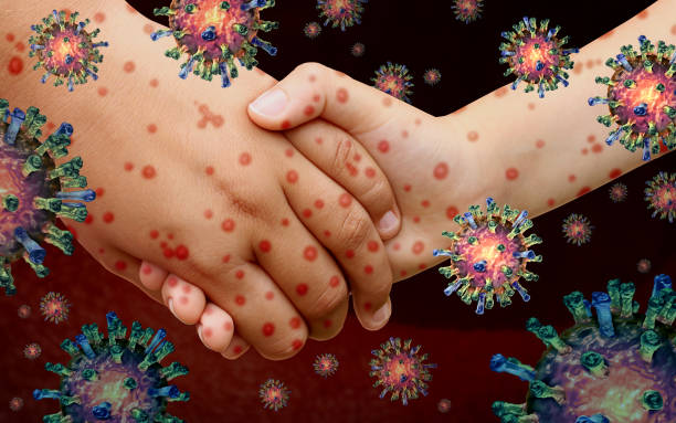 Viral Diseases Viral diseases and measles disease and or virus illness as a contagious chickenpox or a skin rash spreading with contagious cells with 3D illustration elements. measles stock pictures, royalty-free photos & images