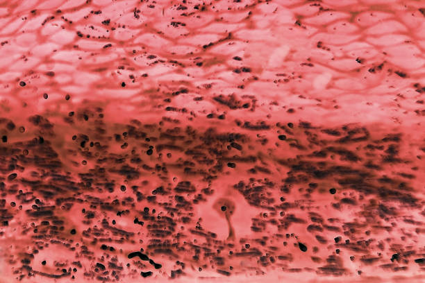 istock cancer cells under a microscope. Tissues affected by cancer cells under the microscope, Science. Cancer drugs. chemistry and biology. 1146057150