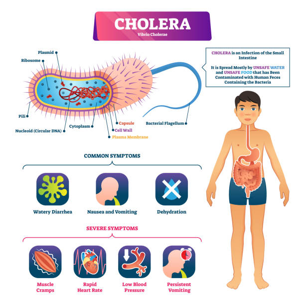 Cholera vector illustration. Labeled infection structure and symptom scheme Cholera vector illustration. Labeled infection structure and symptoms scheme. Educational infographic with unsafe water and food vibrio microorganism that causes diarrhea, vomiting and dehydration. vibrio stock illustrations