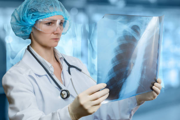 A doctor is examining a lungs image for treatment and diagnosis. A doctor in glasses is standing and looking at the lungs image at the blurred hospital room background. The concept of medical service, diagnosis and treatment. roentgen stock pictures, royalty-free photos & images