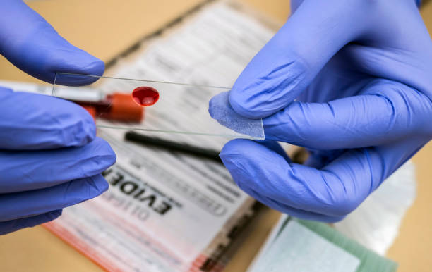 la policía especializada toma muestra sangre en el soporte del microscopio para analizar en laboratorio científico, imagen conceptual - csi fotografías e imágenes de stock
