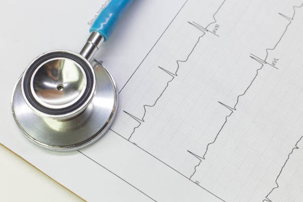 istock Blue stethoscopes and  Electrocardiography  chart close up image. 1146632481