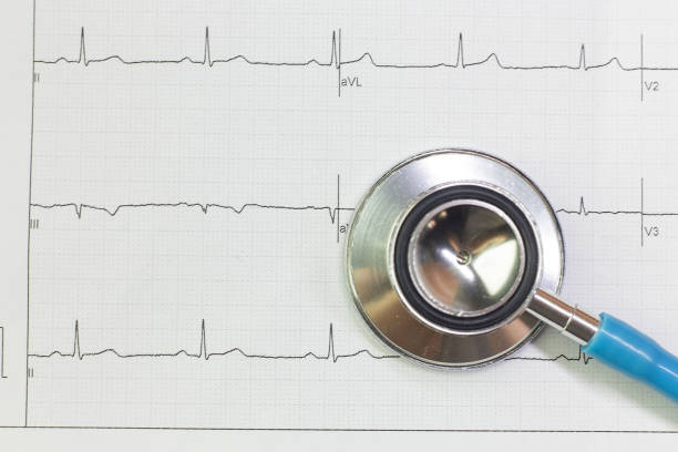 istock Blue stethoscopes and  Electrocardiography  chart close up image. 1146632783