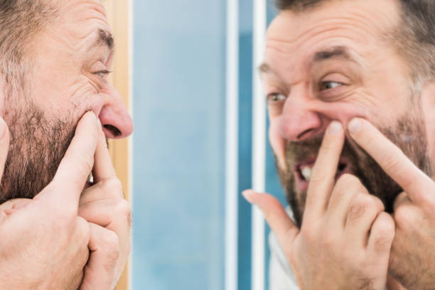 istock Man looking at pimples on his face 1147176299