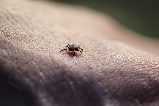 Tick on human skin Tick insect parasite crawling on human skin. Hard tick (Ixodes) bloodsucking photos stock pictures, royalty-free photos & images