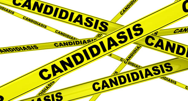 istock Candidiasis. Yellow warning tapes 1147308656
