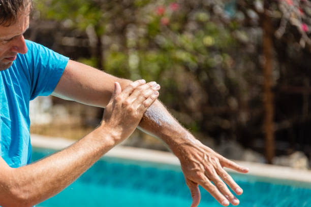istock Male person using sunblock lotion 1147384704