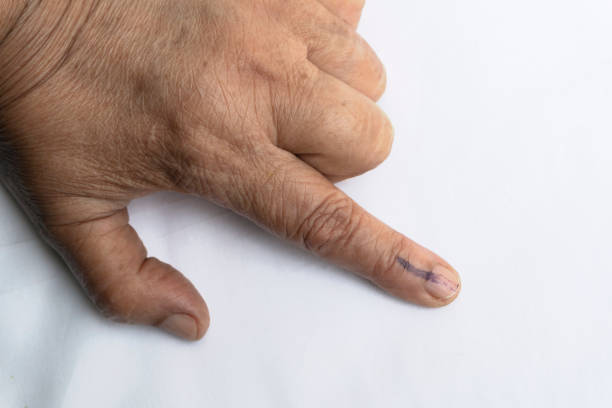 Senior citizen voted and got index finger inked