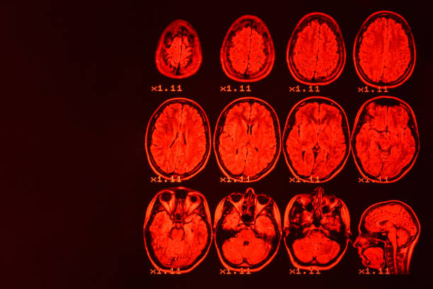 mri do cérebro em um fundo preto com luminoso vermelho. fundo médico - brain mri scanner mri scan medical scan - fotografias e filmes do acervo