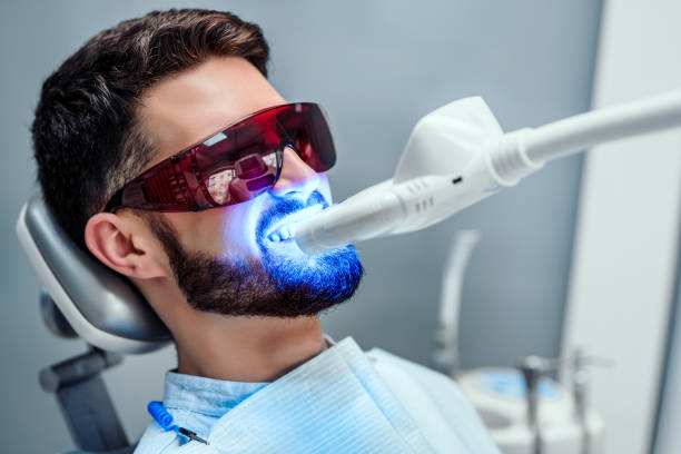 Healthcare and medicine concept. Close up view of man undergoing laser tooth whitening treatment to remove stains and discoloration. dental cavity photos stock pictures, royalty-free photos & images