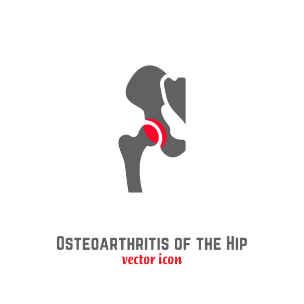 hip osteoarthritis ikone - hip replacement stock-grafiken, -clipart, -cartoons und -symbole