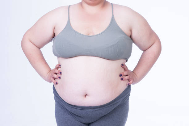 istock obese woman belly fat 1147638169