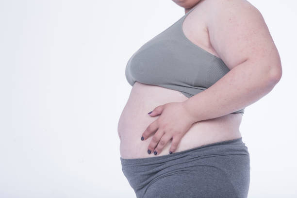 istock obese woman side view 1147638389