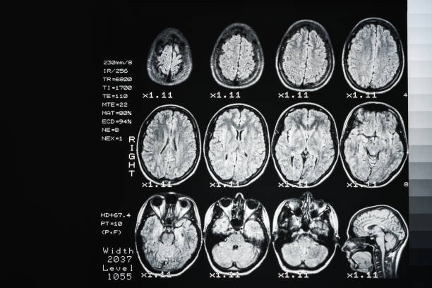 o resultado é uma ressonância magnética do cérebro com valores e números. fundo médico - medical equipment mri scanner mri scan hospital - fotografias e filmes do acervo
