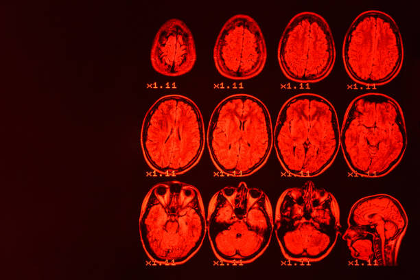 mri do cérebro em um fundo preto com luminoso vermelho. fundo médico - medical equipment mri scanner mri scan hospital - fotografias e filmes do acervo