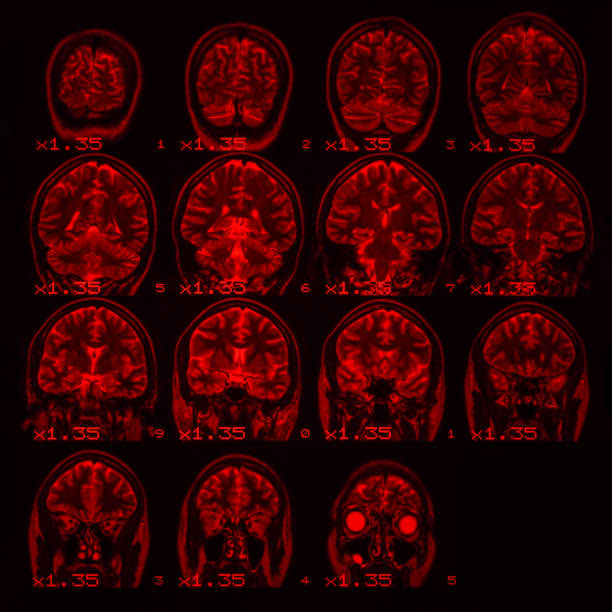 mri of the brain on a black background with red backlight. square photo - brain mri scanner mri scan medical scan imagens e fotografias de stock