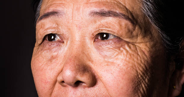 istock Senior asian woman eye 1147722788