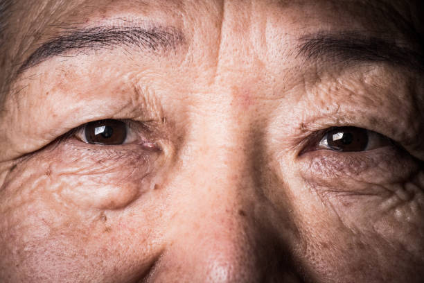 istock Close-up of senior woman's eye 1147722840