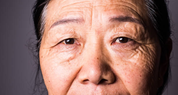 istock Senior asian woman eye 1147723250