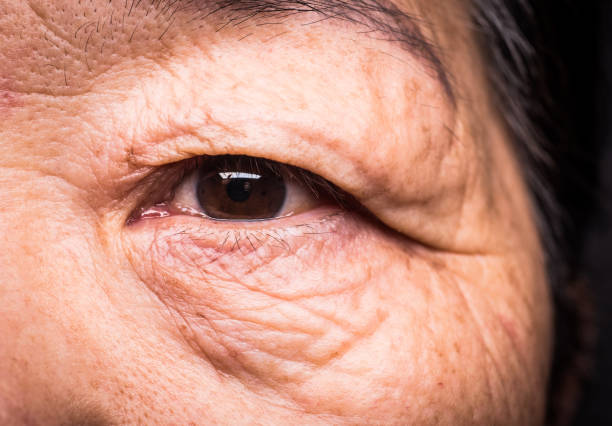 Close-Up Profile Of Senior Human Eye