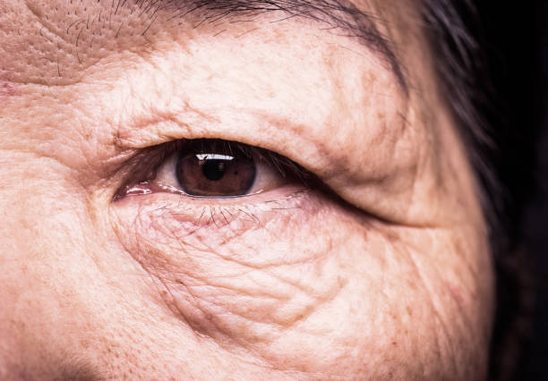 istock Close-up senior woman eye 1147723981