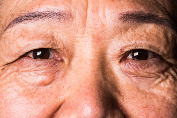 istock Senior asian woman eye 1147724468